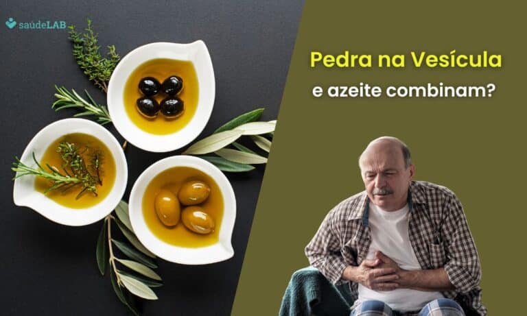 Quem tem pedra na vesícula pode comer azeite? Entenda se ele piora o quadro 5 quem tem pedra na vesícula pode comer azeite.