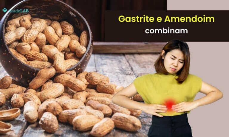 Quem tem gastrite pode comer amendoim? Entenda melhor a questão 3 quem tem gastrite pode comer amendoim.
