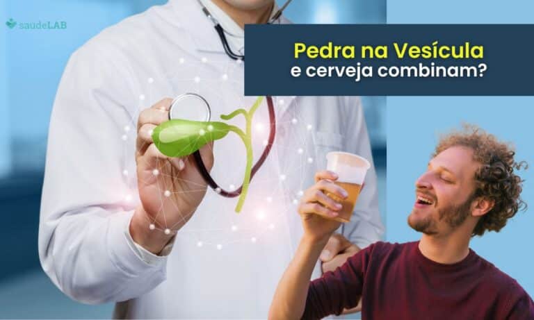 Quem tem pedra na vesícula pode beber cerveja? Entenda mais sobre 6 Quem tem pedra na vesícula pode beber cerveja.