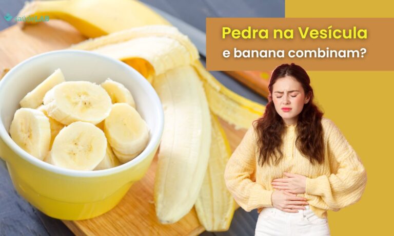 quem tem pedra na vesícula pode comer banana.