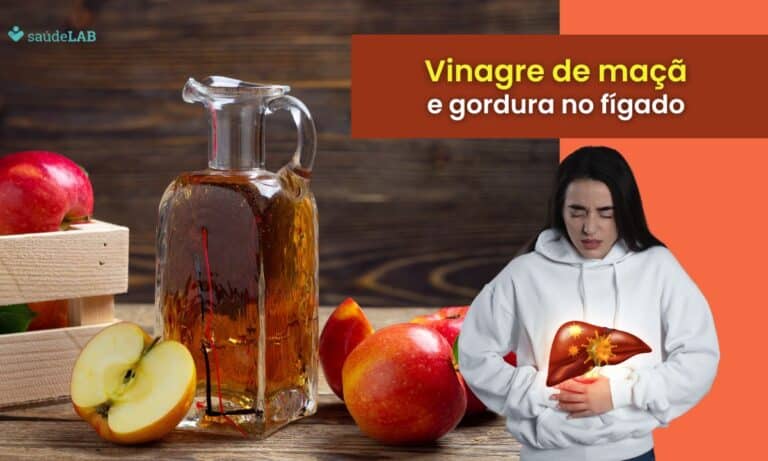 Vinagre de maçã é bom para gordura no fígado.