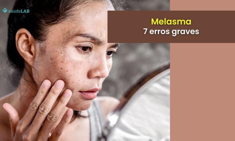 7 erros que pioram o melasma.