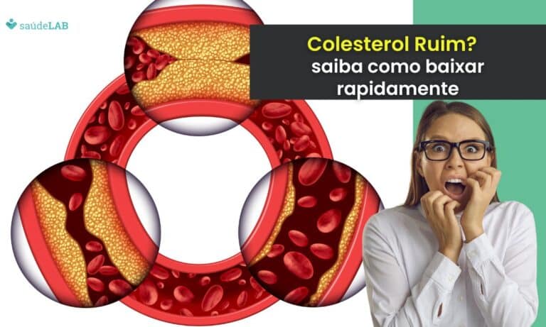 Como baixar o colesterol ruim rapidamente? Melhore sua saúde vascular agora 3 Como baixar o colesterol ruim rapidamente.