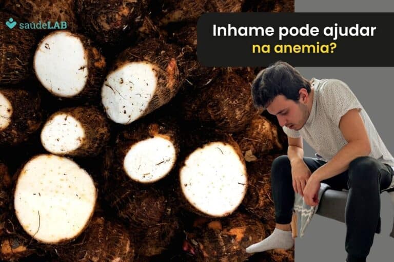 Inhame é bom para anemia? Descubra se vale a pena investir nele 5 Inhame é bom para anemia.