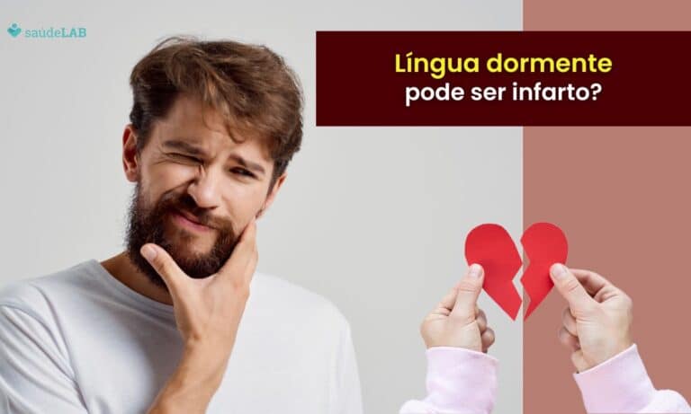 Língua dormente por ser Infarto? Entenda a relação e os sintomas mais comuns 4 Língua dormente pode ser infarto.