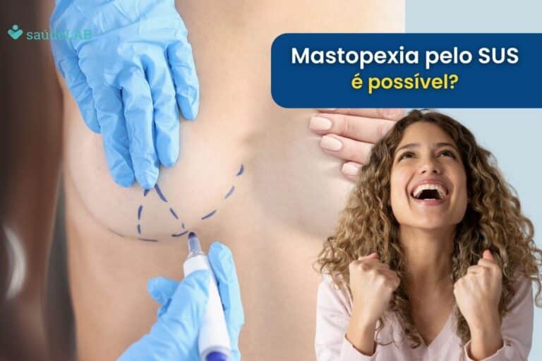 Mastopexia pelo SUS: Será que é possível fazer? Entenda 5 Mastopexia pelo SUS.