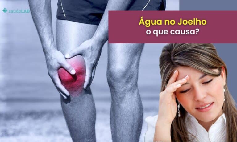 O que causa água no joelho.