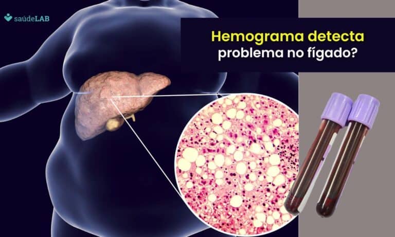 Hemograma detecta problema no fígado.