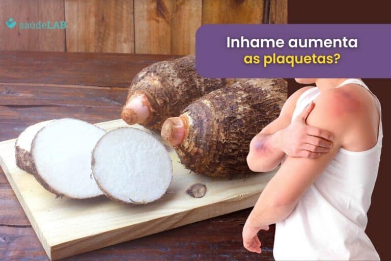 Inhame aumenta plaquetas? Descubra seus verdadeiros efeitos no sangue 8 inhame aumenta plaquetas.