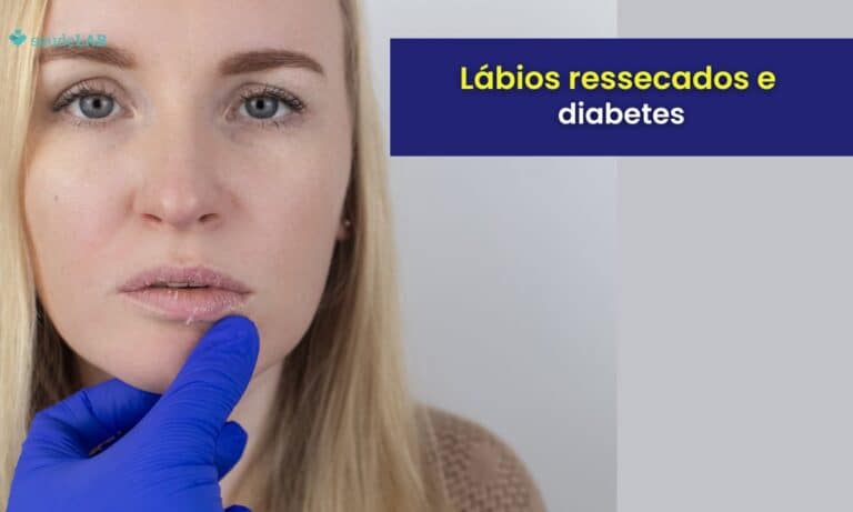 Lábios ressecados e diabetes: entenda como aliviar o sintoma 1 Lábios ressecados e diabetes.