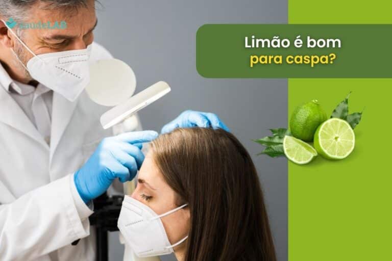 Limão é bom para caspa, ou isso é apenas um mito? Desvende o mistério agora 4 Limão é bom para caspa.