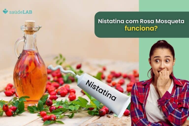 Descubra a eficácia real da Nistatina com Rosa Mosqueta para melasma 4 nistatina com rosa mosqueta para melasma.