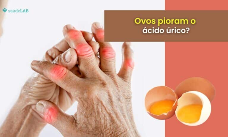 Ovo faz mal para ácido úrico? Saiba como evitar que o problema aumente 1 ovo faz mal para ácido úrico.