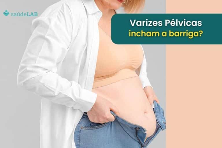 varizes pélvicas incham a barriga.