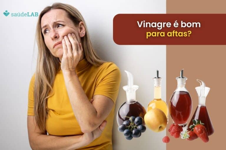 Vinagre é bom para afta? Descubra agora se melhora ou piora a situação 2 Vinagre é bom para afta.