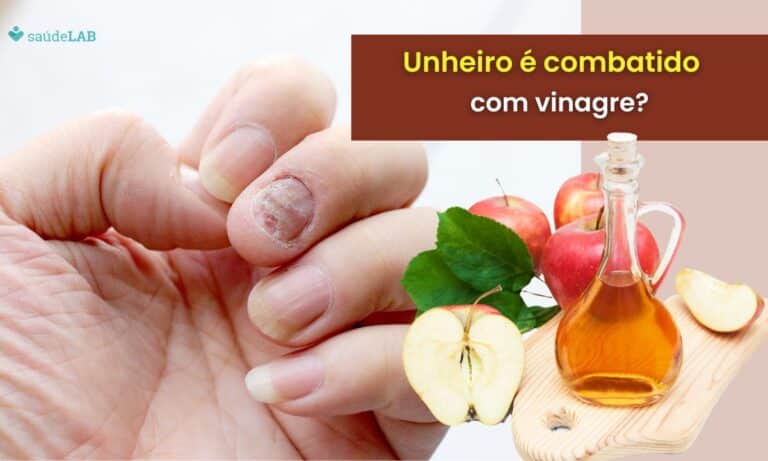 Vinagre é bom para unheiro.