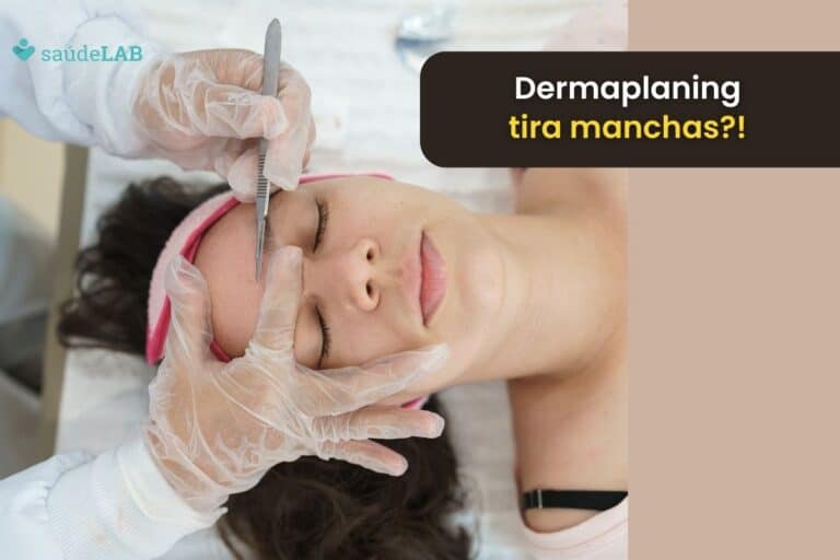Dermaplaning: saiba tudo sobre a esfoliação feita com bisturi 5 Dermaplaning tira manchas.