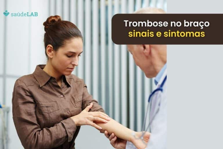 Sintomas de trombose no braço: saiba identificar, quais as causas e consequências 5 Sintomas de trombose no braço.