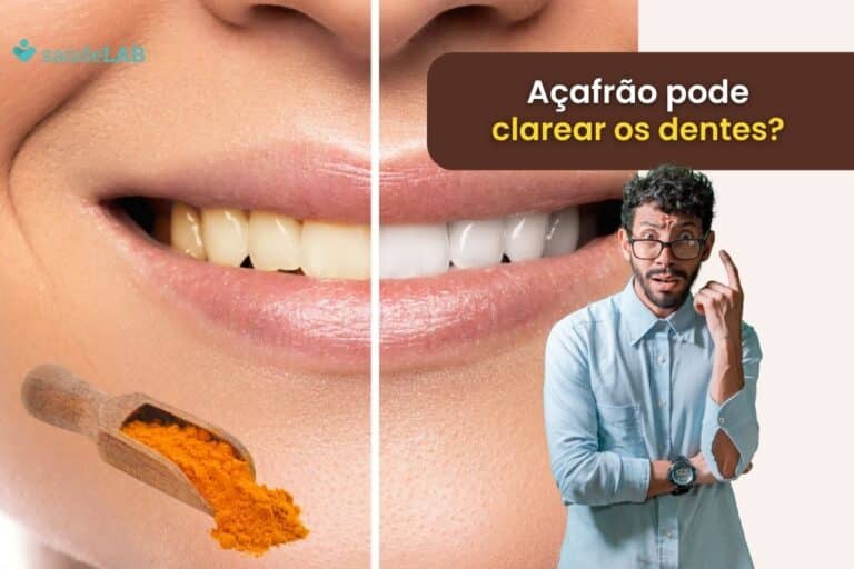 Açafrão clareia os dentes? Descubra se é uma boa ideia ou não 6 Açafrão clareia os dentes.