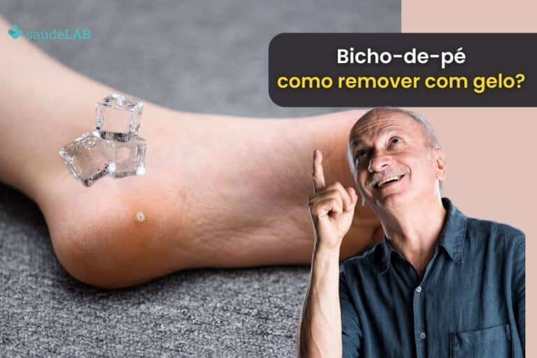 Tem como tirar bicho-de-pé com gelo? Entenda como resolver o problema 3 como tirar bicho-de-pé com gelo.