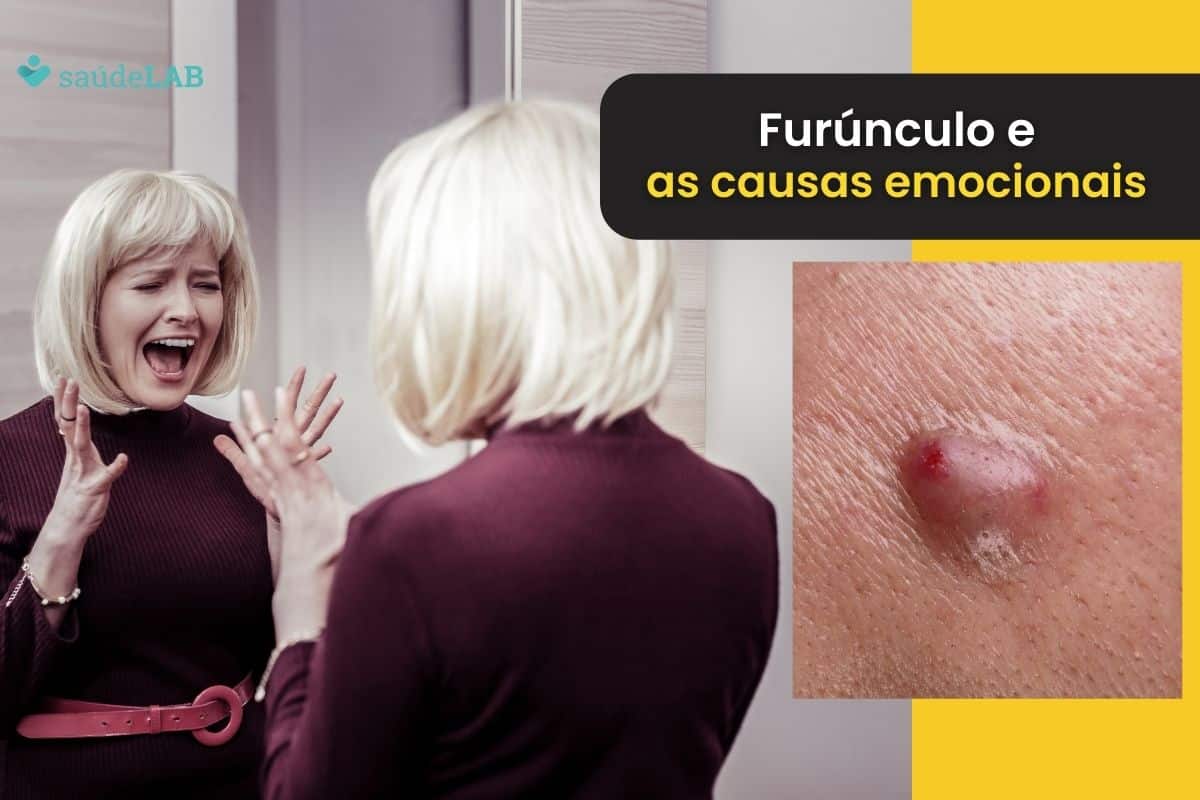 Furúnculo tem causas emocionais? A influência dos sentimentos na saúde da pele 1 furúnculo causas emocionais.