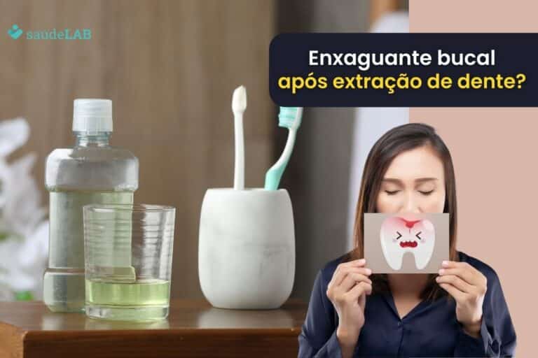 Pode usar enxaguante bucal depois de extrair um dente? Descubra aqui! 6 pode usar enxaguante bucal depois de extrair um dente.