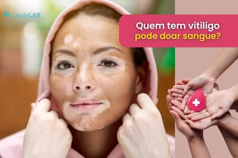 Quem tem vitiligo pode doar sangue? Fazer tatuagem? Saiba tudo aqui 6 quem tem vitiligo pode doar sangue.