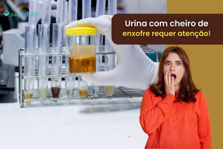 Urina com cheiro de enxofre: o que o sintoma pode ser? Será que é grave? Entenda 7 Urina com cheiro de enxofre.