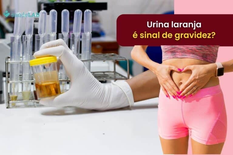 Urina laranja é sinal de gravidez? Ligue o alerta com esse sinal 3 urina laranja é sinal de gravidez.