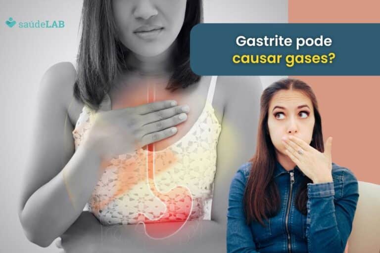 Gastrite causa gases? Entenda o sintoma e confira 6 dicas para melhorar 5 Gastrite causa gases.