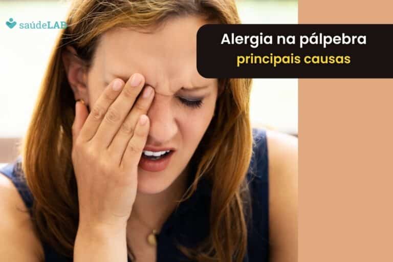 Alergia na pálpebra? Descubra agora as 8 causas mais comuns 2 Moça com sintomas de alergia na pálpebra.