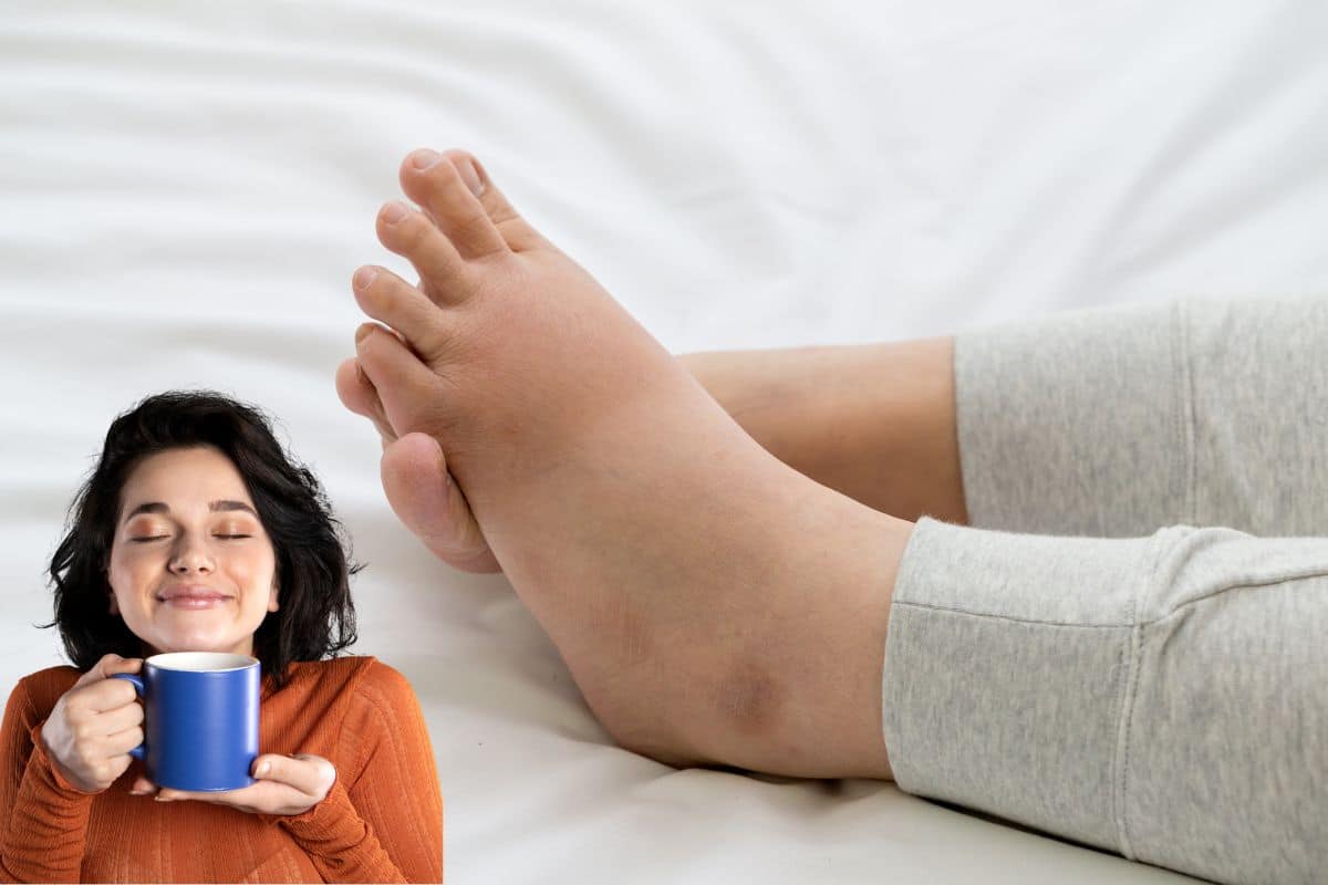 Chás que funcionam: combata o inchaço nos pés de forma natural 1 Mulher tomando chá diurético para desinchar os pés.