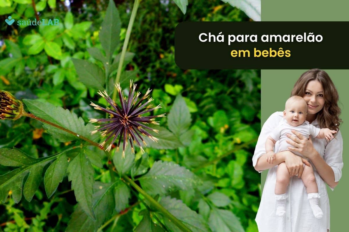 Chá para amarelão em bebê: fique por dentro dessa ótima dica caseira 1 chá para amarelão em bebê.
