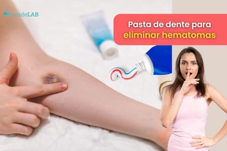 Como tirar roxo da pele com pasta de dente? Veja se o método funciona 4 como tirar roxo da pele com pasta de dente.