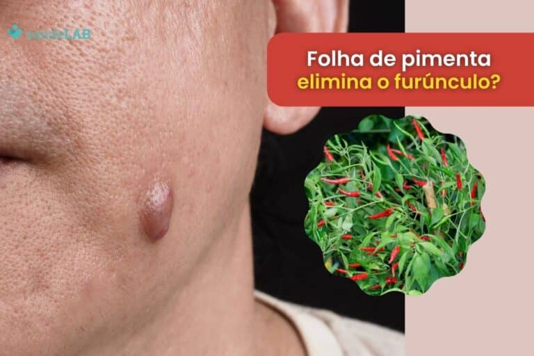 Folha de pimenta para furúnculo: estudo científico prova que a técnica funciona 8 folha de pimenta para furúnculo.