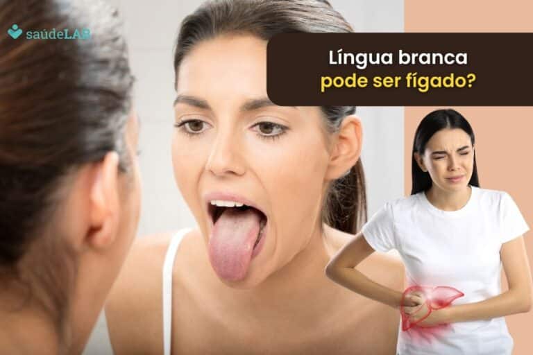 Língua branca e fígado: será que existe uma relação entre os dois? Entenda melhor 1 Língua branca e fígado.