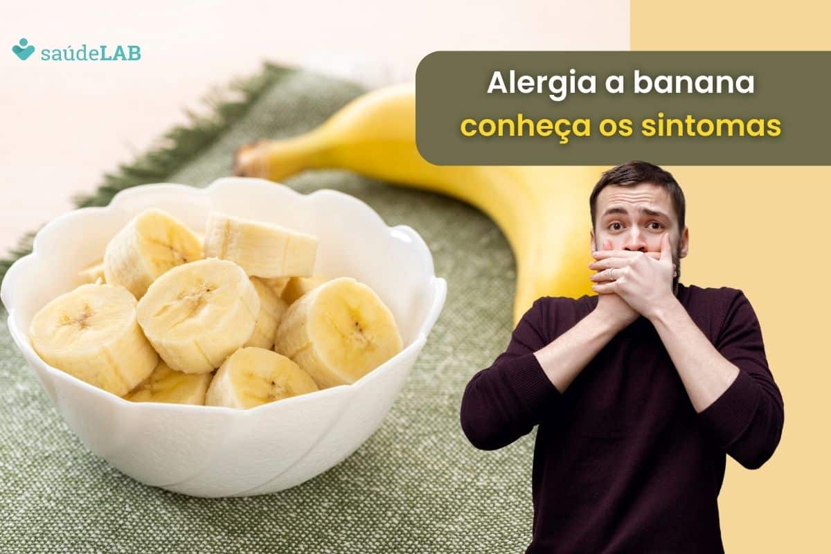 sintomas da alergia a banana.