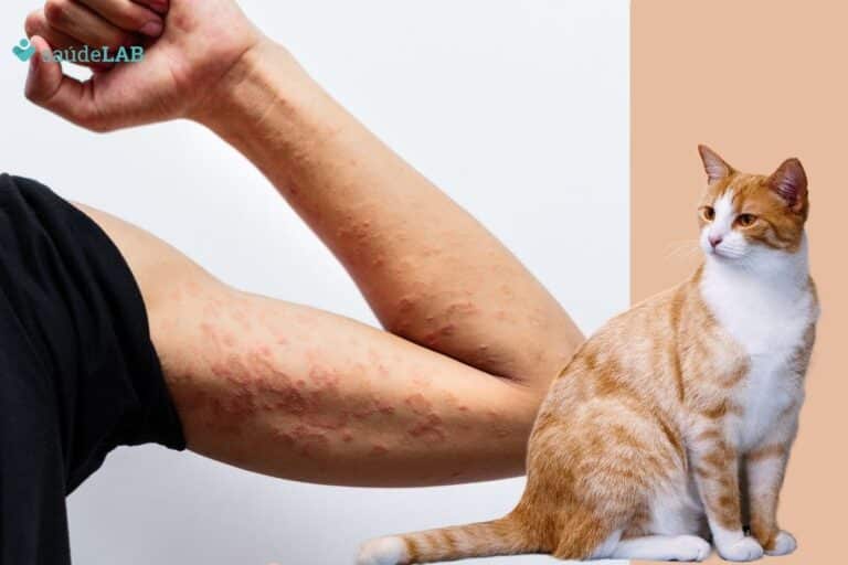 Surto de Esporotricose: o que é a doença transmitida por gatos que está fora de controle 3 esporotricose.