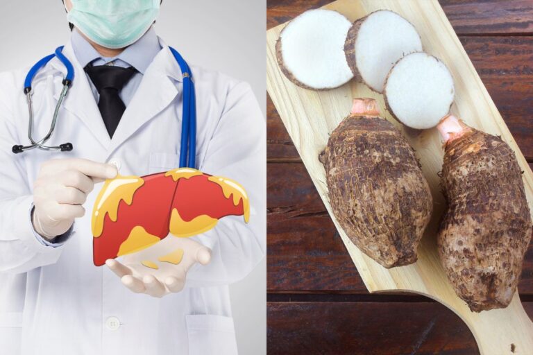 Quem tem gordura no fígado pode comer inhame.