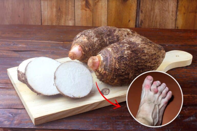 Quem tem ácido úrico elevado pode comer inhame? Entenda 4 Quem tem ácido úrico elevado pode comer inhame.