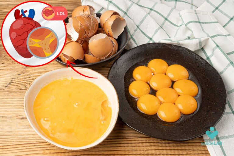 A gema do ovo aumenta o colesterol? Saiba como consumir 7 A gema do ovo aumenta o colesterol.