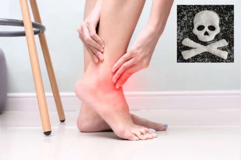 Neuropatia Diabética: causas, sintomas e tratamentos efetivos 6 Neuropatia diabética.