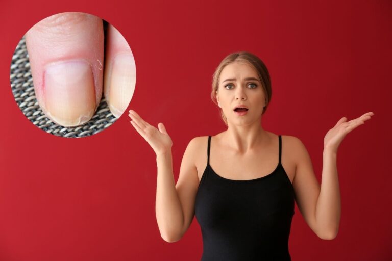 Wavy nails causes, prevention and treatments to keep them healthy