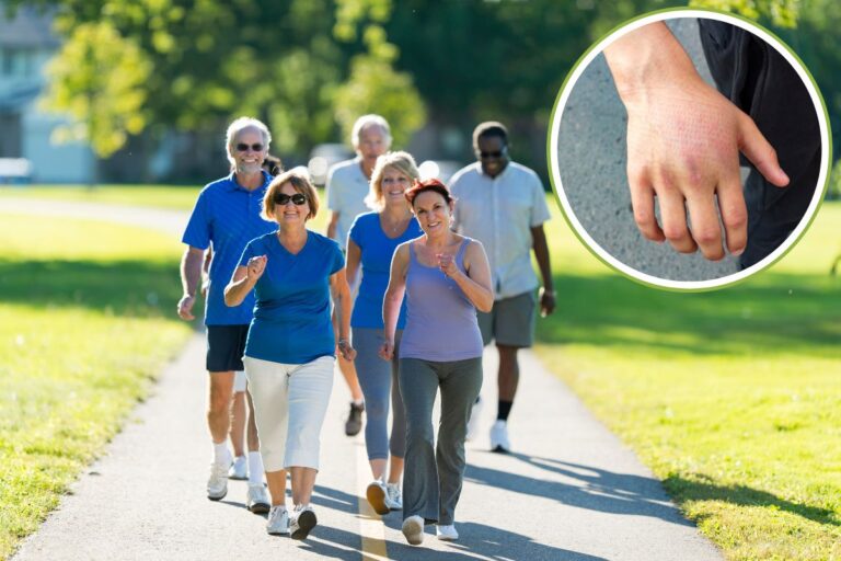 É normal ficar com as mãos inchadas ao caminhar? Saiba o que pode ser 8 Mãos inchadas ao caminhar.