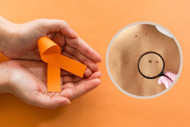 Câncer de pele e o dezembro laranja.