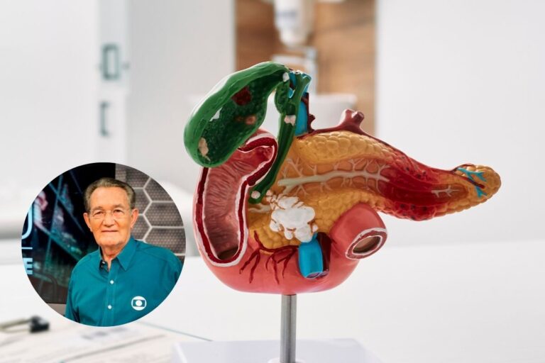 Câncer de Pâncreas.