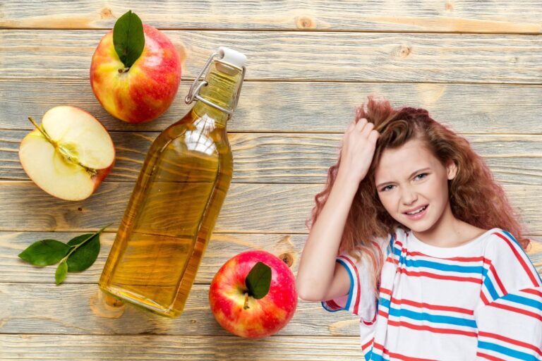 Vinagre de maçã mata piolho ou é mito? Confira se esse truque caseiro realmente funciona 1 vinagre de maçã mata piolho.