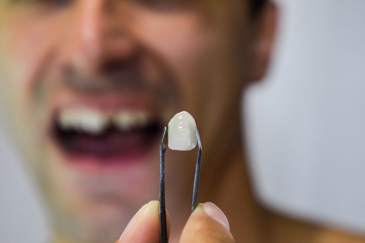 Como perder o medo de dentista? Homem com odontofobia tem infecção dentária espalhada para sua corrente sanguínea 1 Como perder o medo de dentista.