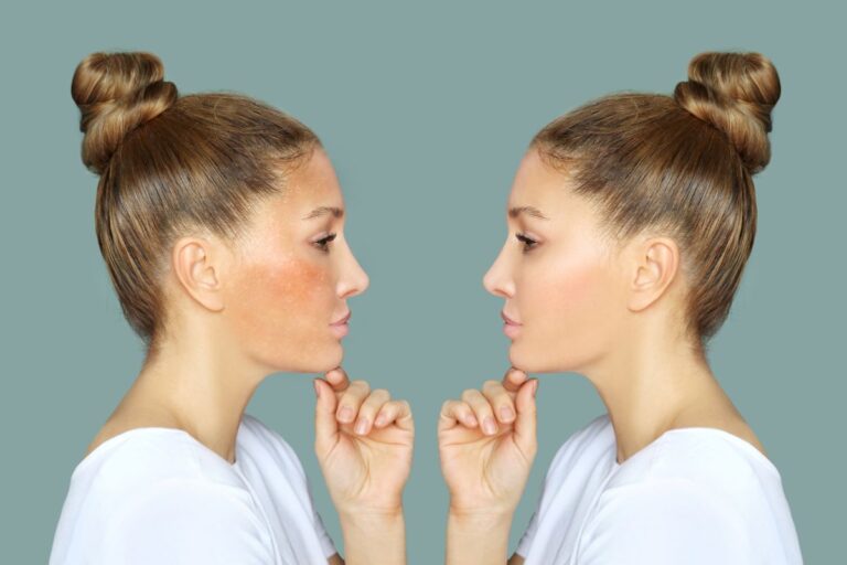 O que é Picnogenol e por que ele está revolucionando a saúde e a beleza? 1 Picnogenol.