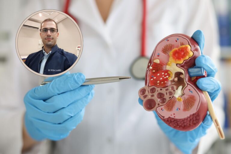 Tumor no rim é grave.